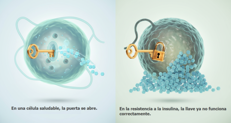 Representación de la resistencia a la insulina y el síndrome X celular
